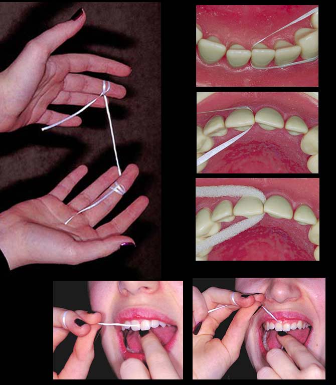 dental floss in goa, floss techniques
