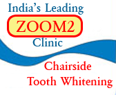 zoom2 chairside tooth whitening